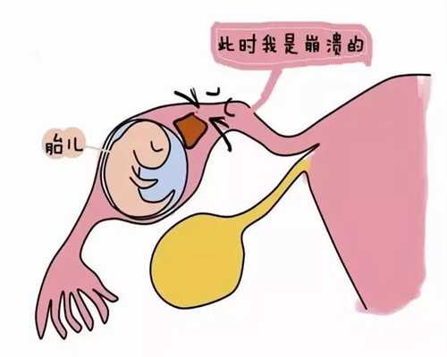 北京代孕医院排名_北京正规代孕网站_宝宝免疫力低下的表现症状